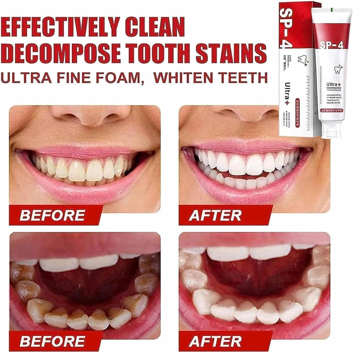 Yayashi SP4 Oral Care Probiotic Whitening Toothpaste 120g – Shine Brig ...