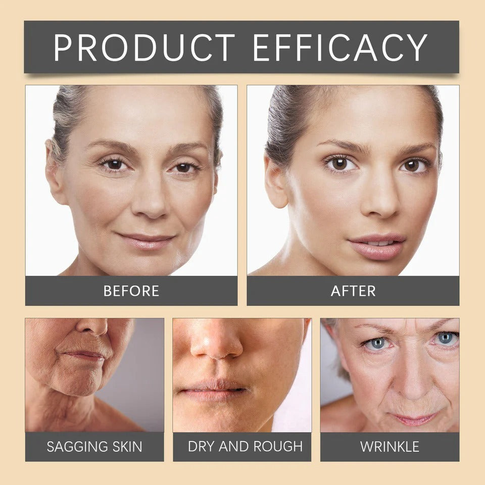 Bee Venom Botox Face Cream ( Buy 1 Get 1 Free )