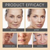 Bee Venom Botox Face Cream ( Buy 1 Get 1 Free )