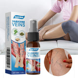 Varicose Veins Treatment Spray - Veins Relief Oil