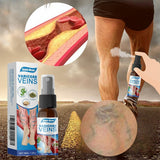Varicose Veins Treatment Spray - Veins Relief Oil