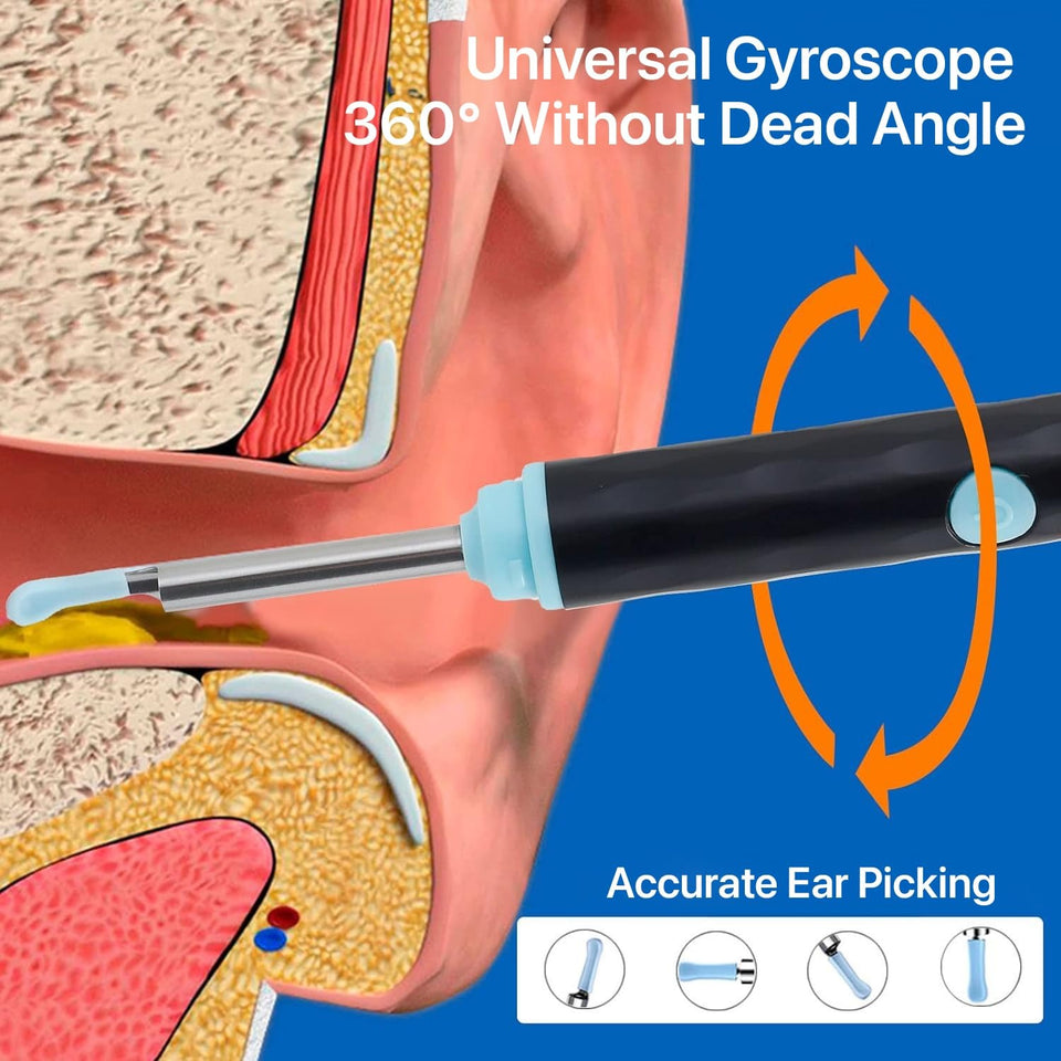Ear Wax Cleaning Device With 1080p Quality Camera