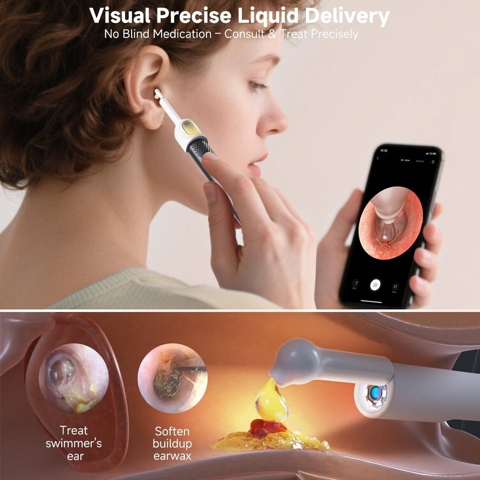 Ear Wax Cleaning Device With 1080p Quality Camera