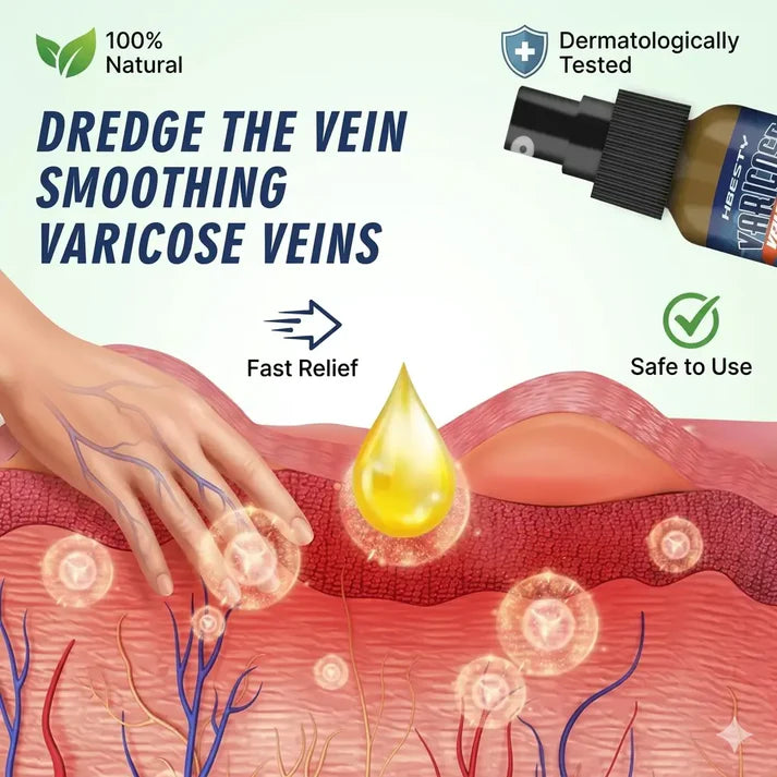 Varicose Veins Treatment Spray - Veins Relief Oil