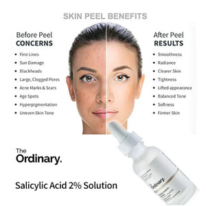 PACK OF 2 THE ORDINARY NIACINAMIDE WITH BATCH CODE