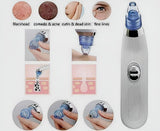 Derma Suction Blackheads Remover 3 In 1 Black Head Remover Machine-acne Pimple Pore Cleaner Vacuum Suction Tool (cell Operated)